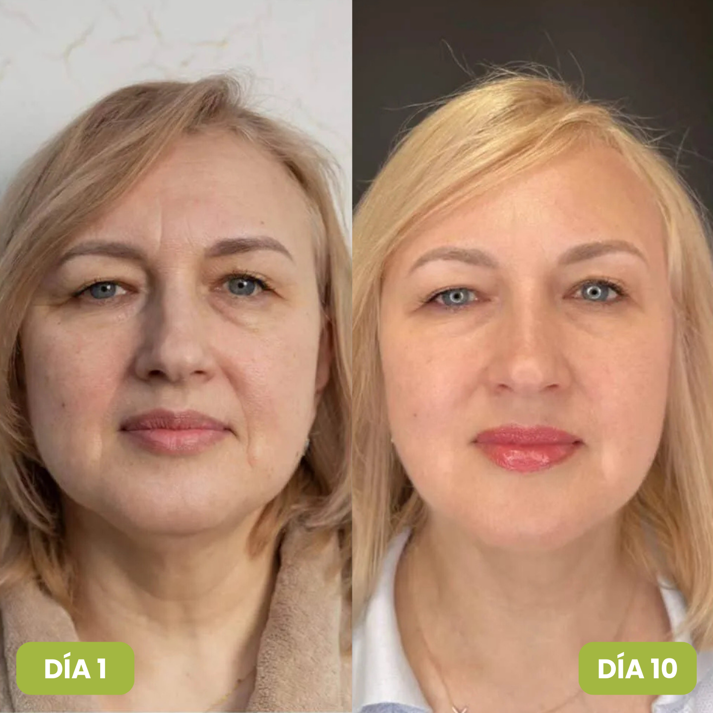 2X1 Sérum de Extracto de Noni